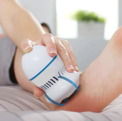 Vacuum Callus Remover – product image